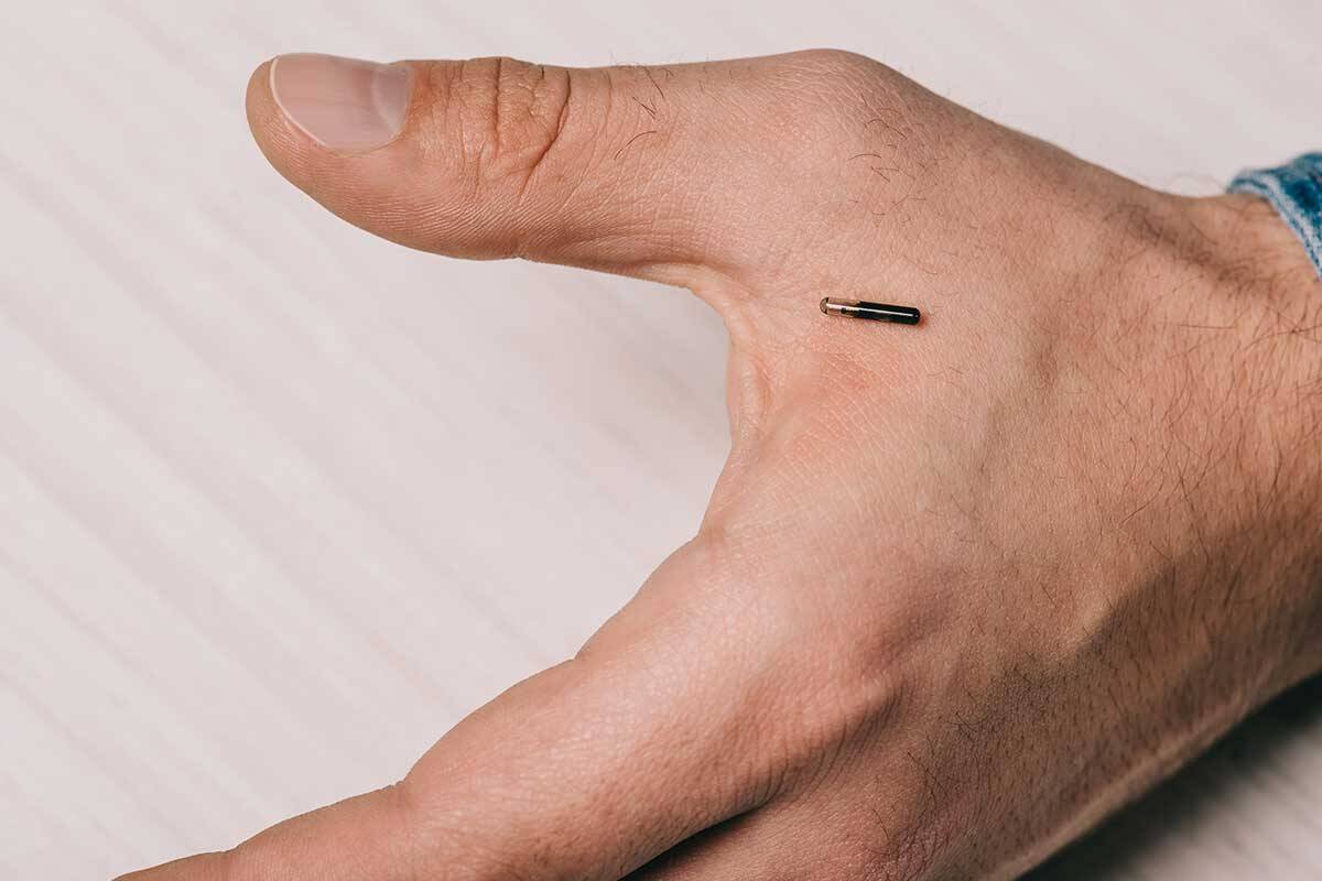 Article image for Why people are getting microchips implanted in their hand