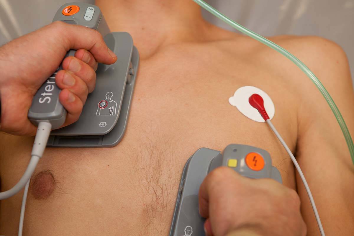 Article image for Paramedic shocked using new defibrillation technique being trialled in Victoria