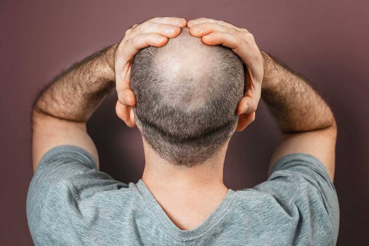 Article image for The old hair loss myth that is ‘nonsense’