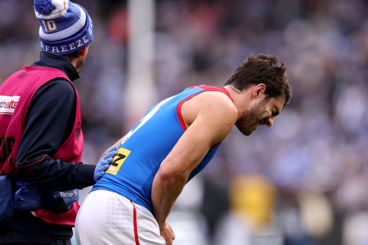 Article image for ‘We have the best medical care’: AFL CEO confident right process was followed with Petracca injury