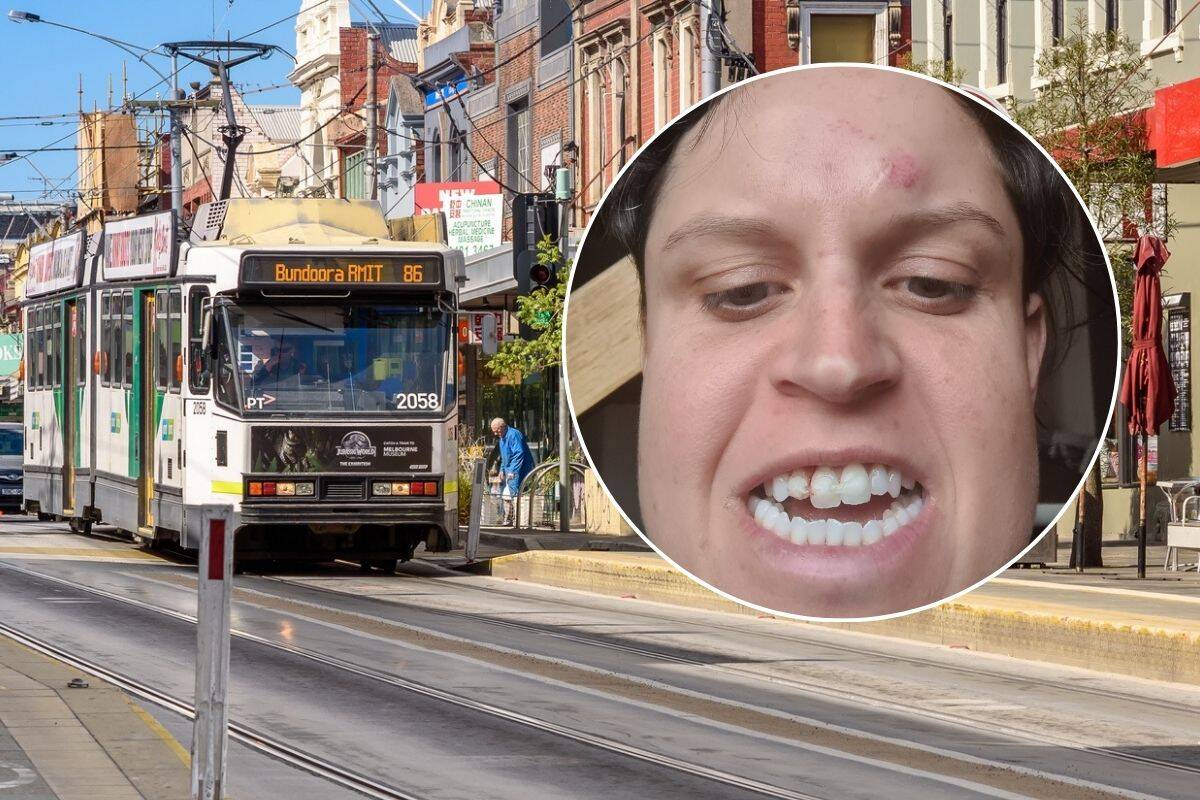 Article image for ‘Pissed off’: Woman tees off on Labor and the Greens after violent encounter on tram