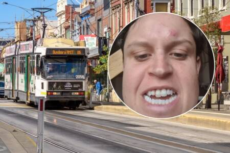 ‘Pissed off’: Woman tees off on Labor and the Greens after violent encounter on tram