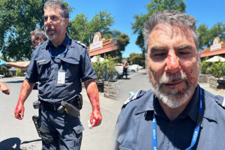 ‘Sore and sorry’: Police officer left bloodied after brutal bashing in Bendigo