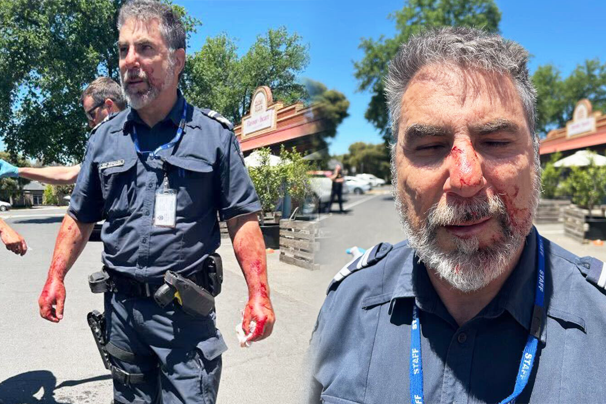 Article image for ‘Sore and sorry’: Police officer left bloodied after brutal bashing in Bendigo